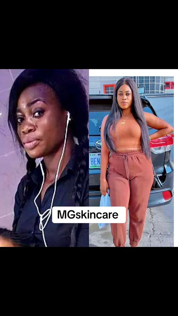 Skin Transformation 1