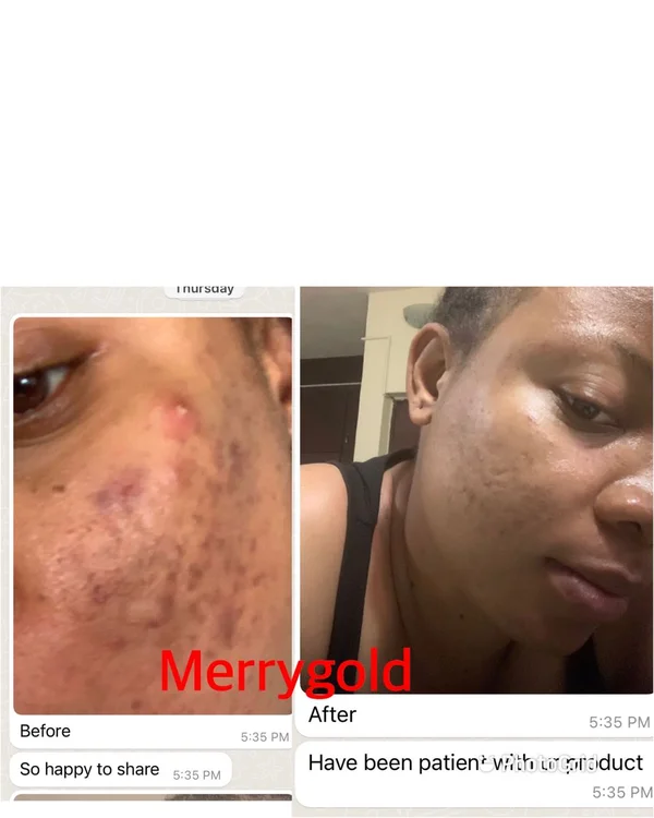 Skin Transformation 2