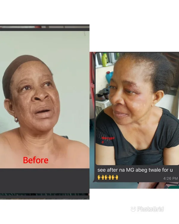Skin Transformation 3