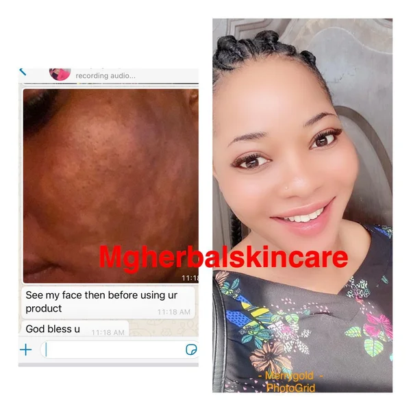 Skin Transformation 7